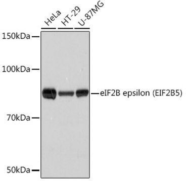 Anti-eIF2B epsilon (EIF2B5) Antibody, clone 5M2D4, Rabbit Monoclonal