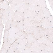 Anti-EMX1 antibody produced in rabbit Prestige Antibodies® Powered by Atlas Antibodies, affinity isolated antibody, buffered aqueous glycerol solution