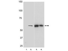 Anti-phospho-Akt (Thr308) Antibody, clone 50-1C-25, rabbit monoclonal clone NL50, Upstate®, from rabbit