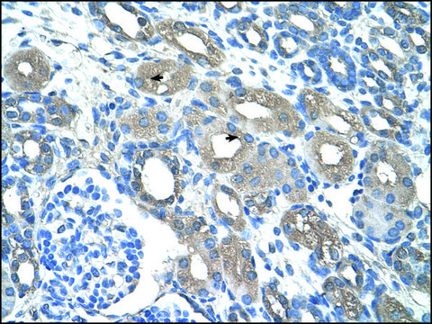 Anti-RSAD2 (AB2) antibody produced in rabbit IgG fraction of antiserum