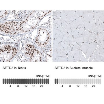 Monoclonal Anti-SETD2 antibody produced in mouse Prestige Antibodies&#174; Powered by Atlas Antibodies, clone CL9956, purified immunoglobulin, buffered aqueous glycerol solution