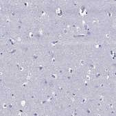 Anti-TRIM31 antibody produced in rabbit Prestige Antibodies® Powered by Atlas Antibodies, affinity isolated antibody, buffered aqueous glycerol solution