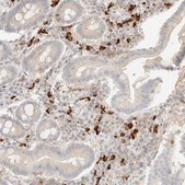 Anti-FHOD1 antibody produced in rabbit Prestige Antibodies® Powered by Atlas Antibodies, affinity isolated antibody, buffered aqueous glycerol solution