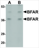 Anti-BFAR antibody produced in rabbit affinity isolated antibody, buffered aqueous solution
