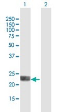 ANTI-LOH12CR1 antibody produced in mouse purified immunoglobulin, buffered aqueous solution