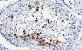 Anti-Geminin Antibody, clone 1K11 ZooMAb® Rabbit Monoclonal recombinant, expressed in HEK 293 cells