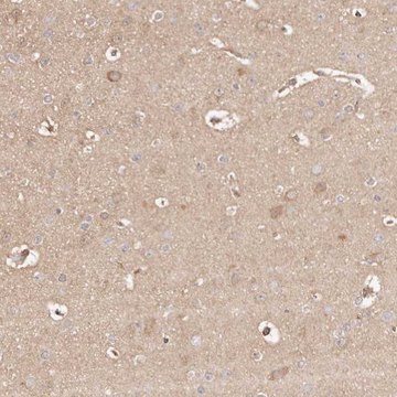 Anti-MAPK1 antibody produced in rabbit Prestige Antibodies&#174; Powered by Atlas Antibodies, affinity isolated antibody, buffered aqueous glycerol solution