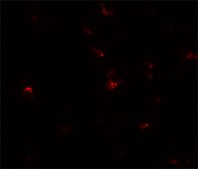 Anti-TGM7 antibody produced in rabbit affinity isolated antibody