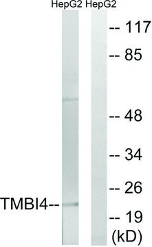 Anti-TMBIM4 antibody produced in rabbit affinity isolated antibody