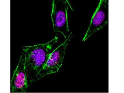 Anti-SMAD1 Antibody, clone AS22 clone AS22, from mouse