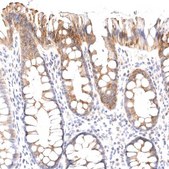 Anti-VPS45 antibody produced in rabbit Prestige Antibodies® Powered by Atlas Antibodies, affinity isolated antibody, buffered aqueous glycerol solution