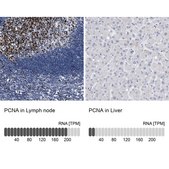 Anti-PCNA antibody produced in rabbit Prestige Antibodies® Powered by Atlas Antibodies, affinity isolated antibody, buffered aqueous glycerol solution, ab3