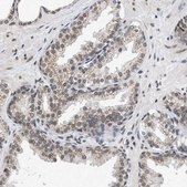 Anti-NUP35 antibody produced in rabbit Prestige Antibodies® Powered by Atlas Antibodies, affinity isolated antibody, buffered aqueous glycerol solution