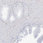 Anti-DMRTB1 antibody produced in rabbit Prestige Antibodies® Powered by Atlas Antibodies, affinity isolated antibody, buffered aqueous glycerol solution