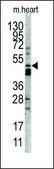 Anti-FUCA2 (C-term) antibody produced in rabbit IgG fraction of antiserum, buffered aqueous solution