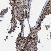 Anti-CBX5 antibody produced in rabbit Prestige Antibodies® Powered by Atlas Antibodies, affinity isolated antibody, buffered aqueous glycerol solution