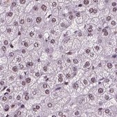 Anti-RCOR3 antibody produced in rabbit Prestige Antibodies® Powered by Atlas Antibodies, affinity isolated antibody, buffered aqueous glycerol solution