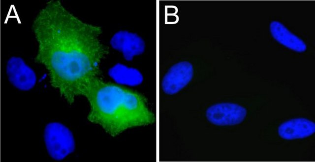 Anti-Myc Tag Antibody, clone 4A6, Alexa Fluor&#8482; 488 conjugate clone 4A6, Upstate&#174;, from mouse