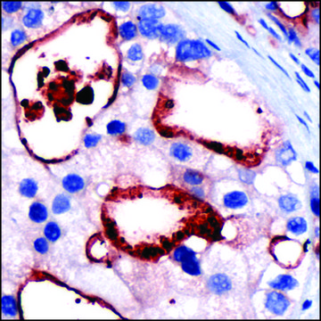 Anti-PSMA antibody, Rabbit monoclonal clone SP29, recombinant, expressed in proprietary host, tissue culture supernatant