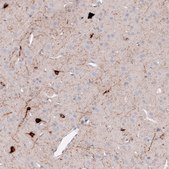 Monoclonal Anti-SST antibody produced in mouse Prestige Antibodies® Powered by Atlas Antibodies, clone CL15076, purified antibody (Protein A)
