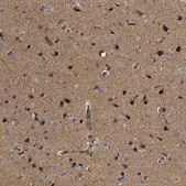 Anti-NAV1 antibody produced in rabbit Prestige Antibodies® Powered by Atlas Antibodies, affinity isolated antibody, buffered aqueous glycerol solution