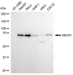 KD-Validated Anti ABCD1 Antibody, clone 23GB3125, Rabbit Monoclonal clone 23GB3125, recombinant rabbit monoclonal, expressed in HEK293 cells
