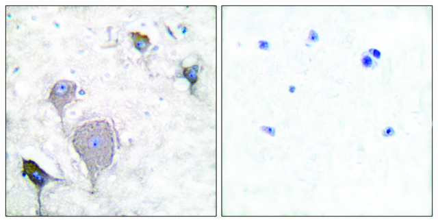 Anti-Peripherin antibody produced in rabbit affinity isolated antibody