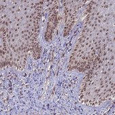 Anti-NCBP2 antibody produced in rabbit Prestige Antibodies® Powered by Atlas Antibodies, affinity isolated antibody, buffered aqueous glycerol solution