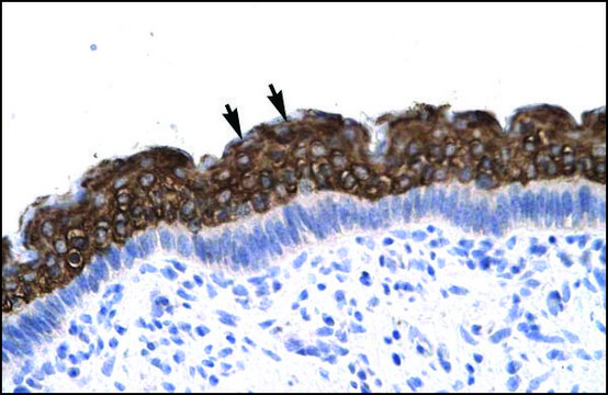 Anti-AEBP1 antibody produced in rabbit affinity isolated antibody