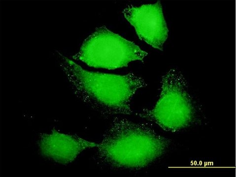 Anti-IL6 antibody produced in mouse IgG fraction of antiserum, buffered aqueous solution