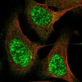 Anti-CWF19L2 antibody produced in rabbit Prestige Antibodies® Powered by Atlas Antibodies, affinity isolated antibody, buffered aqueous glycerol solution