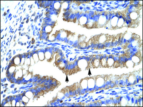 Anti-CLIC5 antibody produced in rabbit IgG fraction of antiserum