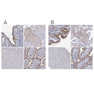 Anti-SLC9A3 antibody produced in rabbit Prestige Antibodies&#174; Powered by Atlas Antibodies, affinity isolated antibody, buffered aqueous glycerol solution