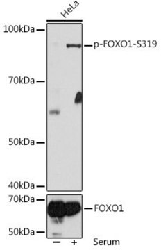 Anti-Phospho-FOXO1-S319 antibody produced in rabbit