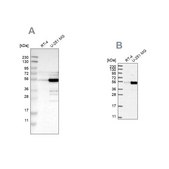 Anti-PDLIM7 antibody produced in rabbit Prestige Antibodies® Powered by Atlas Antibodies, affinity isolated antibody, buffered aqueous glycerol solution