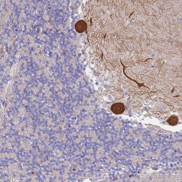 Anti-CYLD antibody produced in rabbit Prestige Antibodies&#174; Powered by Atlas Antibodies, affinity isolated antibody, buffered aqueous glycerol solution