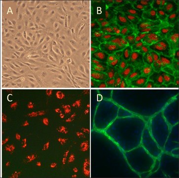 Human Umbilical Vein Endothelial Cells: HUVEC, neonatal