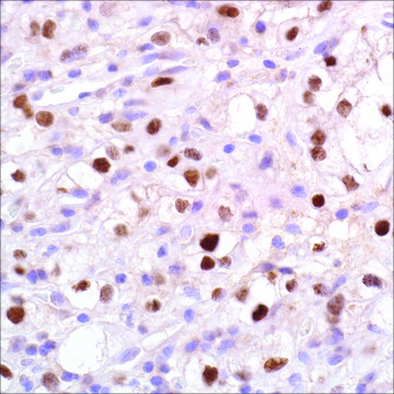 PAX-2 (EP235) Rabbit Monoclonal Primary Antibody