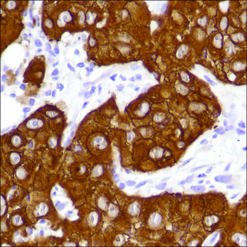 Anti-EGFR antibody, Rabbit monoclonal recombinant, expressed in proprietary host, clone SP111, affinity isolated antibody