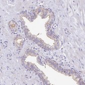 Anti-VPS26B antibody produced in rabbit Prestige Antibodies® Powered by Atlas Antibodies, affinity isolated antibody, buffered aqueous glycerol solution