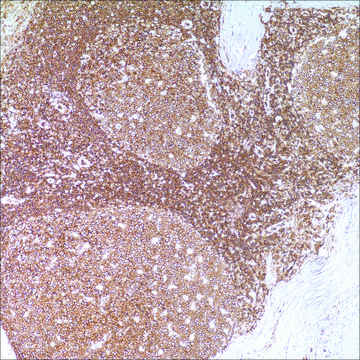 CD45 (LCA) (2B11 &amp; PD7/26) Mouse Monoclonal Antibody