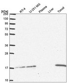 Anti-UBE2A antibody produced in rabbit Prestige Antibodies® Powered by Atlas Antibodies, affinity isolated antibody