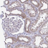 Anti-MRPS16 antibody produced in rabbit Prestige Antibodies® Powered by Atlas Antibodies, affinity isolated antibody, buffered aqueous glycerol solution