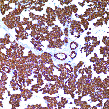 Cytokeratin 8 &amp; 18 (B22.1 &amp; B23.1) Mouse Monoclonal Antibody