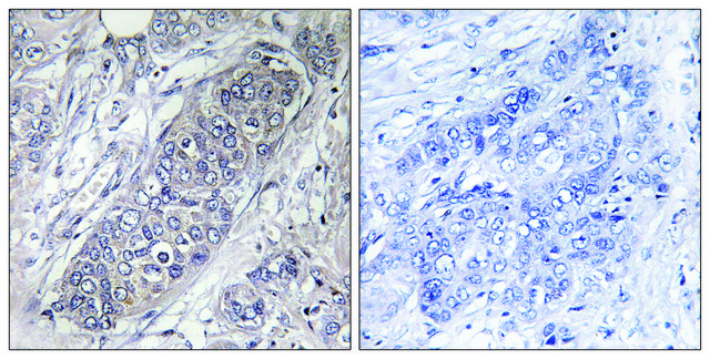 Anti-4E-BP1 antibody produced in rabbit affinity isolated antibody