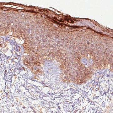 Monoclonal Anti-RNASE7 antibody produced in mouse Prestige Antibodies&#174; Powered by Atlas Antibodies, clone CL0224, purified immunoglobulin, buffered aqueous glycerol solution