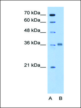 Anti-ALDOC antibody produced in rabbit affinity isolated antibody