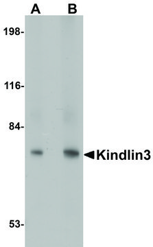 Anti-KINDLIN3 antibody produced in rabbit affinity isolated antibody, buffered aqueous solution