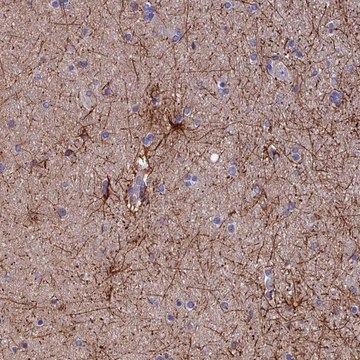 Anti-USP37 antibody produced in rabbit Prestige Antibodies&#174; Powered by Atlas Antibodies, affinity isolated antibody, buffered aqueous glycerol solution