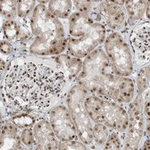 Anti-YTHDC1 antibody produced in rabbit Prestige Antibodies® Powered by Atlas Antibodies, affinity isolated antibody, buffered aqueous glycerol solution